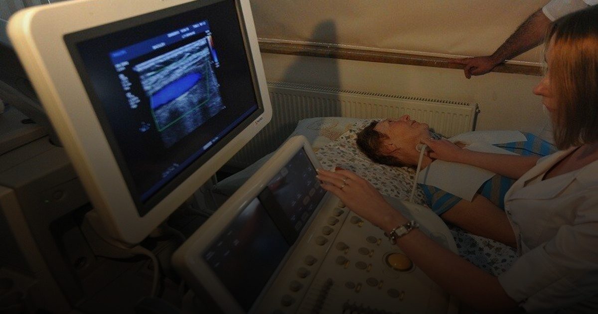 تنبيه عصبي: الصداع والدوخة قد يكشفان تضيق أوعية الرقبة