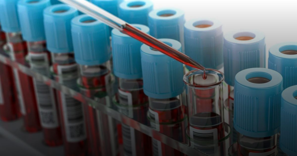 "بصمة دم" ذكية تلاحق انتكاس سرطان الكبد بعد الزرع