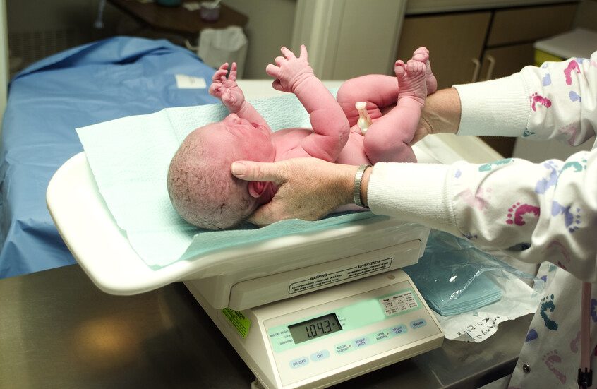 دراسة تكشف علاقة وزن الولادة بالسكتة الدماغية