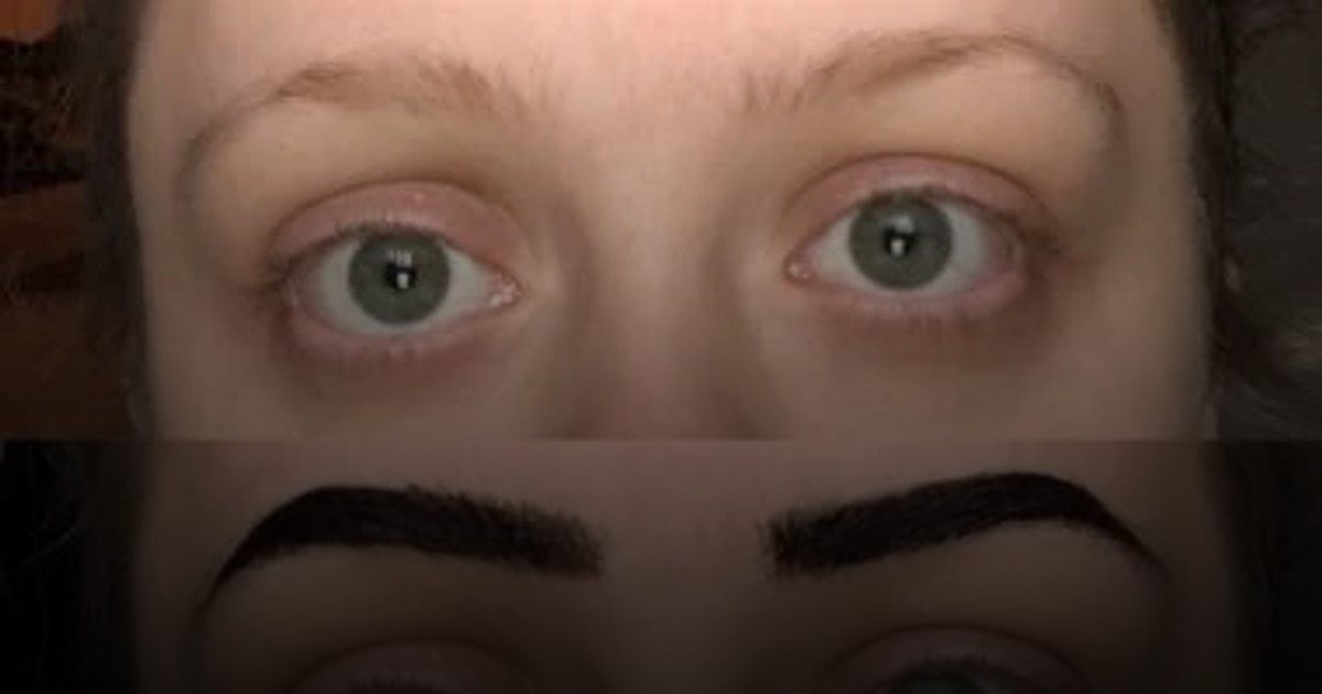 كيف يكشف ترقق الحواجب نقص اليود؟