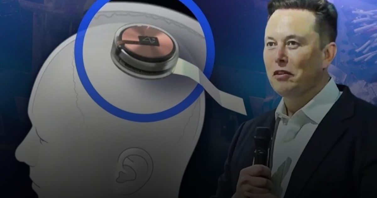 نيورالينك المملوكة لماسك تزرع شرائح دماغية لـ12 شخصاً مصابين بالشلل