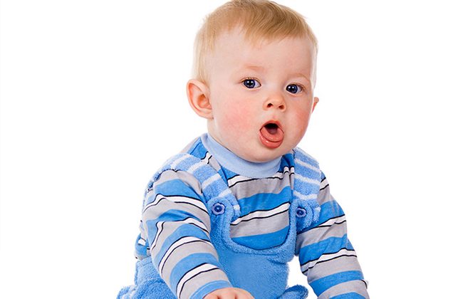 سعال الصيف لدى الأطفال: أكثر من نزلة برد عابرة