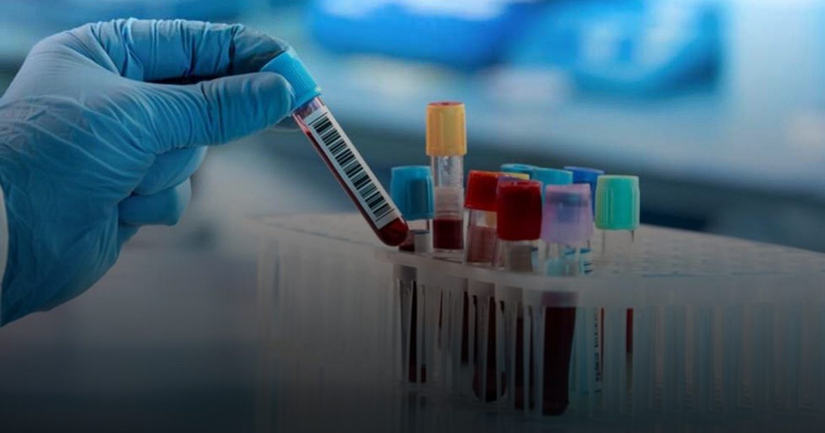 د.عسيري: التحقق المتأني من السلوك أدق من فحص المخدرات قبل الزواج