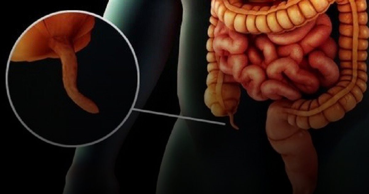 خزان المناعة الخفي.. الزائدة الدودية "مستودع" للبكتيريا النافعة وليست عضواً زائداً