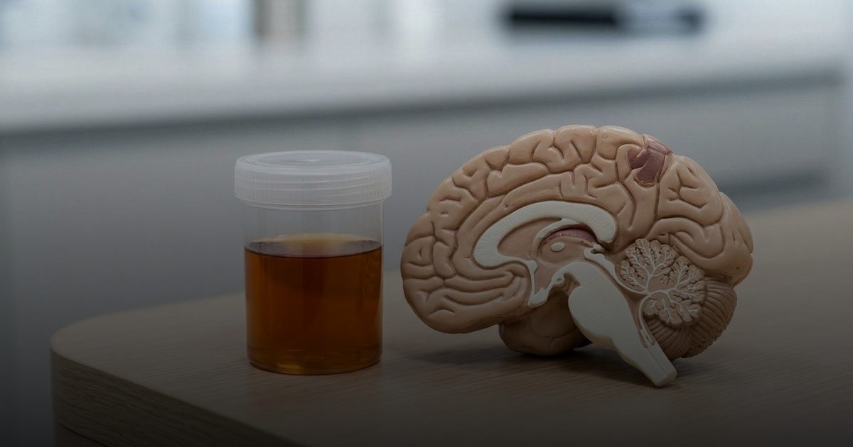 دراسة ترى ارتباط قوي بين التهابات المسالك البولية والخرف