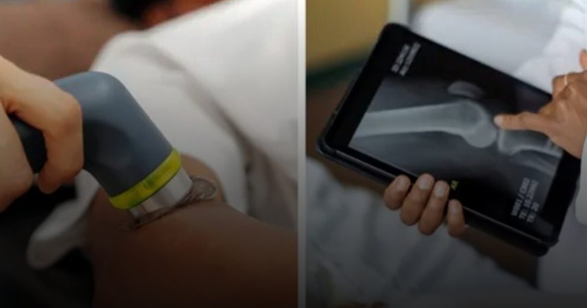 مسدس كوري يعالج الكسور