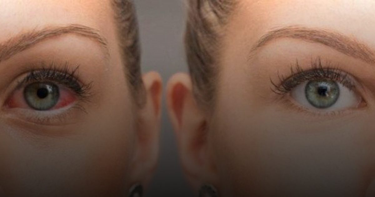 تحذير طبي: متلازمة "شوجرن" الأكثر شيوعاً بين المناعة الذاتية... والكشف المبكر يمنع الأورام