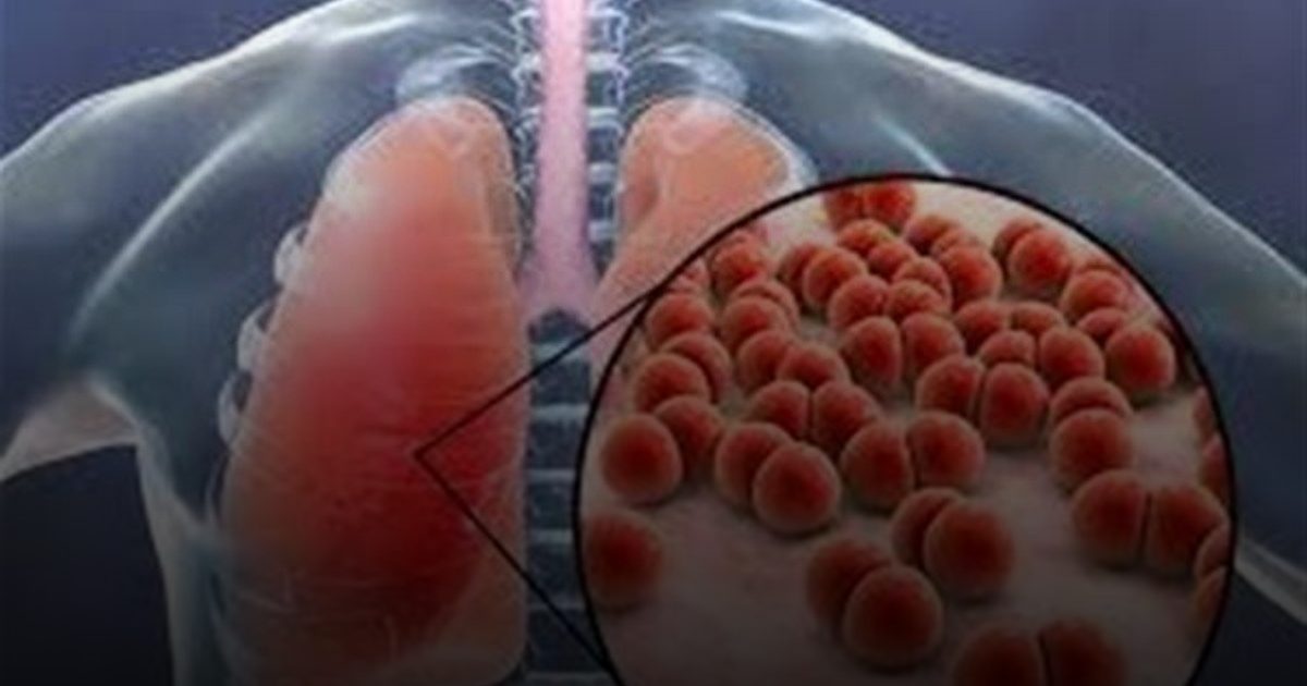 "رسائل الحياة".. التقنية البسيطة تضاعف فرص تعافي مرضى السل