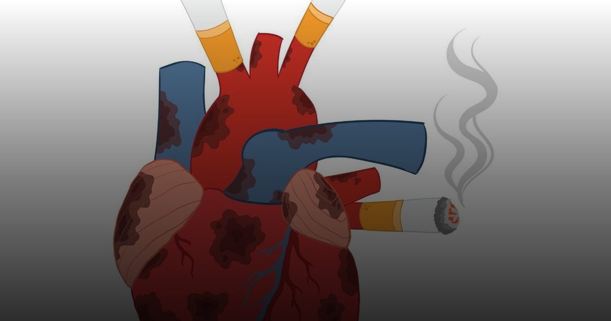 الخلط بين السجائر العادية والإلكترونية.. فخ طبي يهدد الناجين من السكتة الدماغية