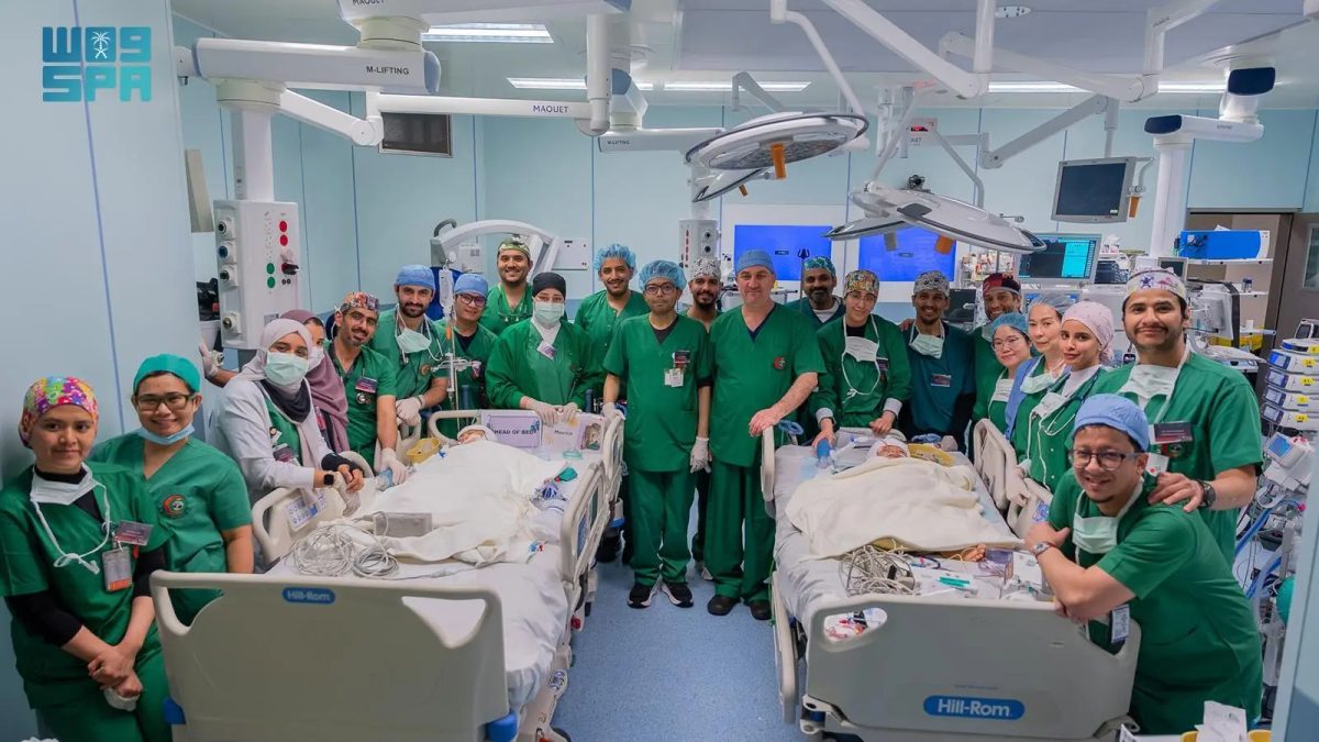 نجاح سعودي عالمي في فصل التوأم الفلبيني الملتصق كليا وموريس آن