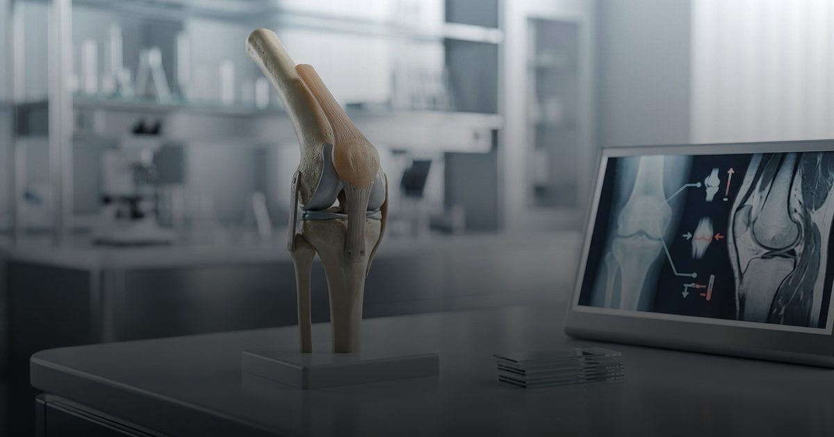 ألم المفاصل: خطر التشخيص الخاطئ لأمراض شائعة ونادرة