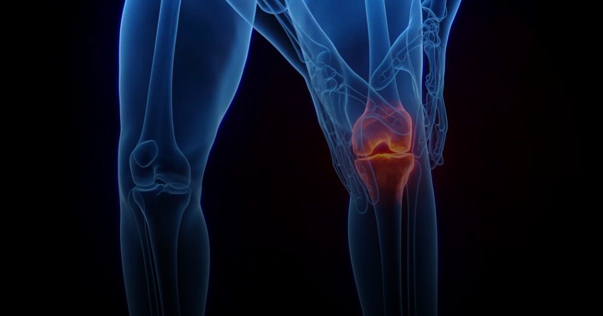 علاج جديد ينهي آلام المفاصل المزمنة دون تدخل جراحي