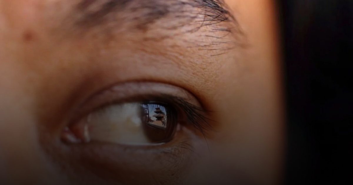 حقن الذهب في العين مستقبل الحفاظ على البصر...