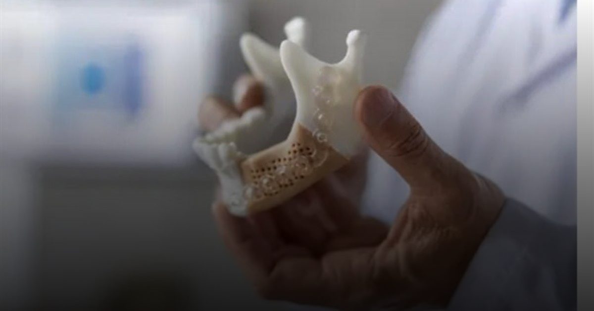 الزجاج بديلاً للعظام.. ابتكار صيني يمهد لثورة في الجراحة