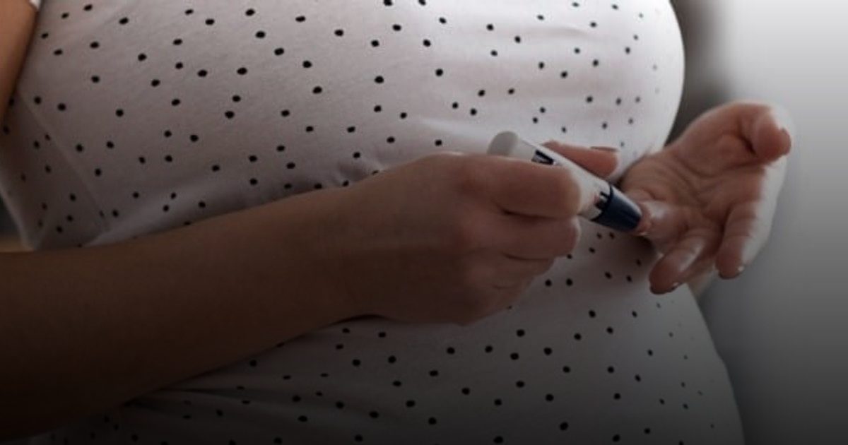 الإفراط في تناول حمض الفوليك يرتبط بسكري الحمل