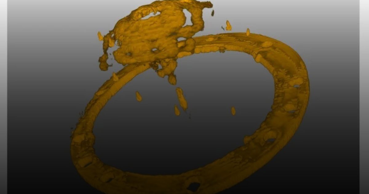 تصوير السرطان بالرادار.. طريقة جديدة لتقليل خطر الإشعاع