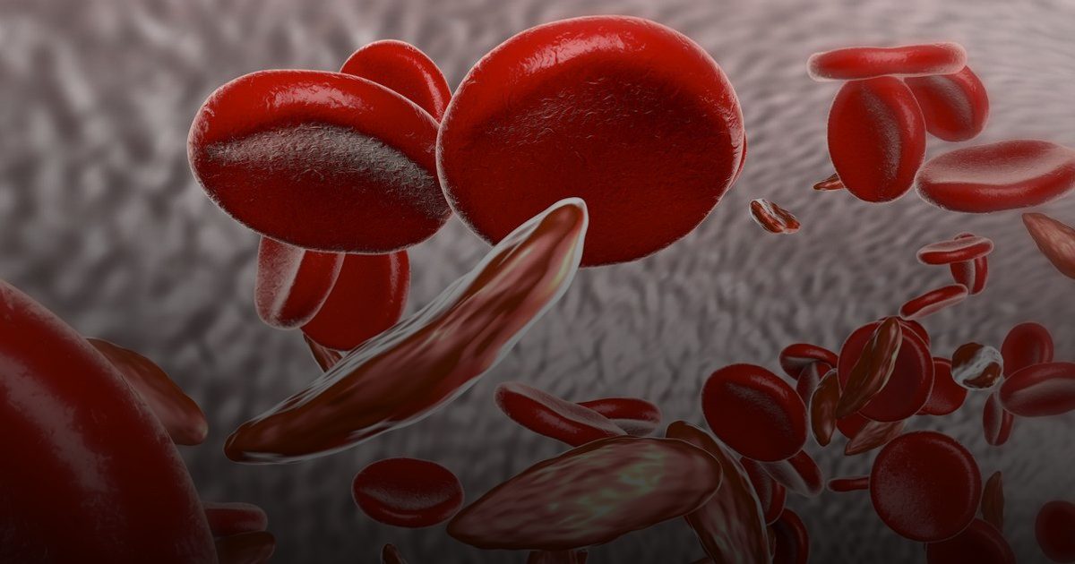 بصمة وراثية معقدة: اجتماع "المنجلية" و"الثلاسيميا" يهدد الأجيال بمرض مشترك