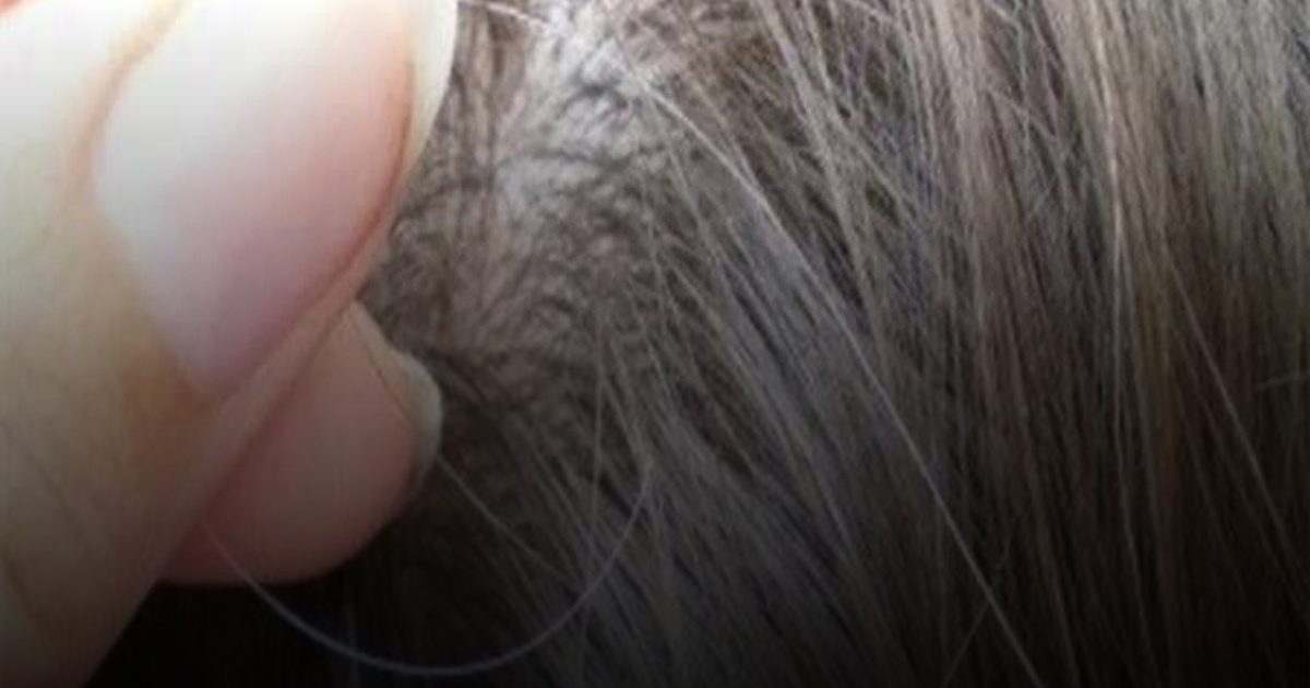 الشيب المبكر ليس حتميا إليك أبرز أسبابه وطرق تأخير ظهوره