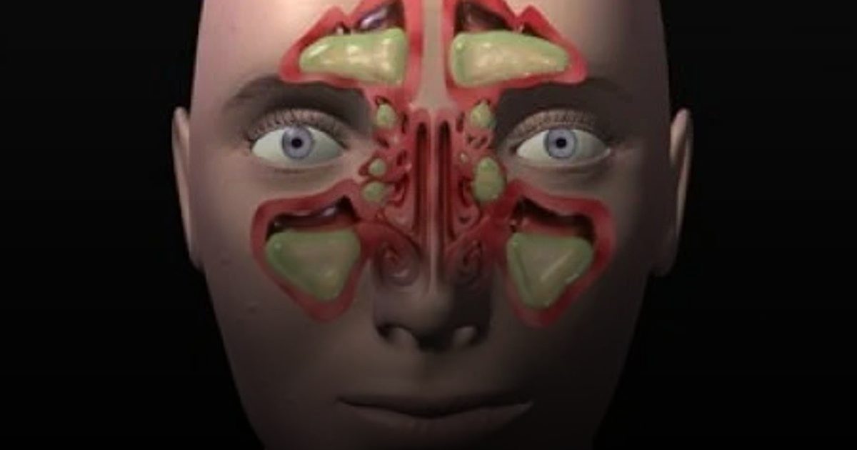 الحساسية الموسمية: 4 استراتيجيات طبيعية لـ "تحصين" الجسم ضد نوبات العطس وحكة العين