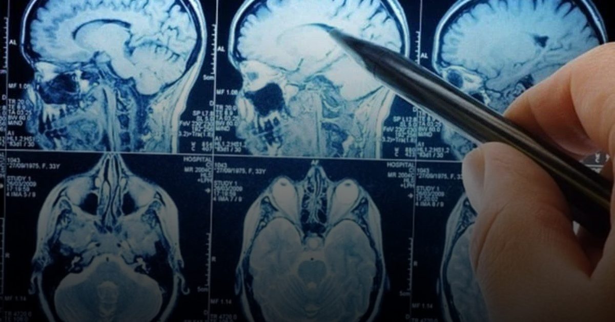 علماء يكتشفون طريقة لإبطاء أخطر أنواع السرطان