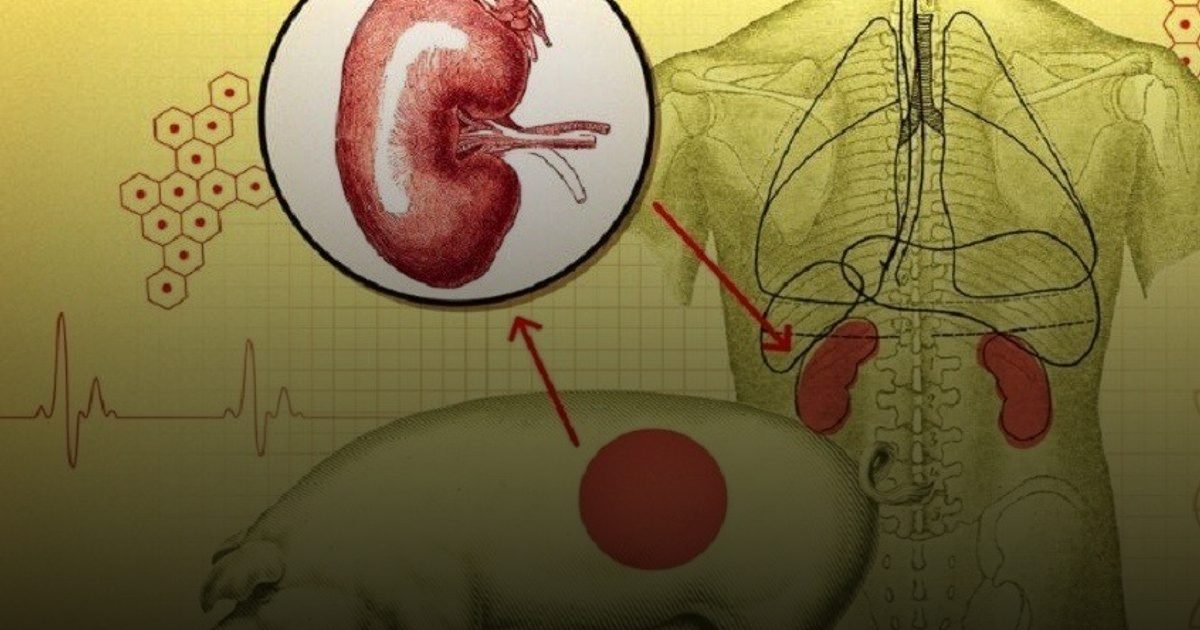 دراسات تكشف الخلايا المناعية للعضو المزروع هي سر رفض كلية الخنزير