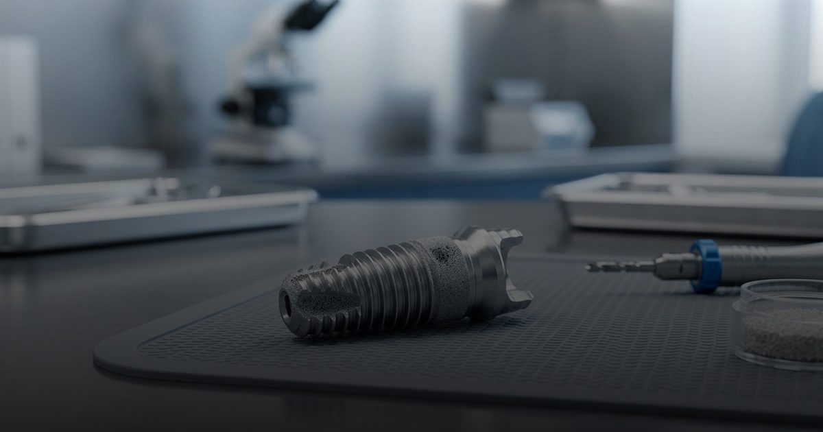 ابتكار روسي يُحدث ثورة في علاجات زراعة الأسنان التقليدية