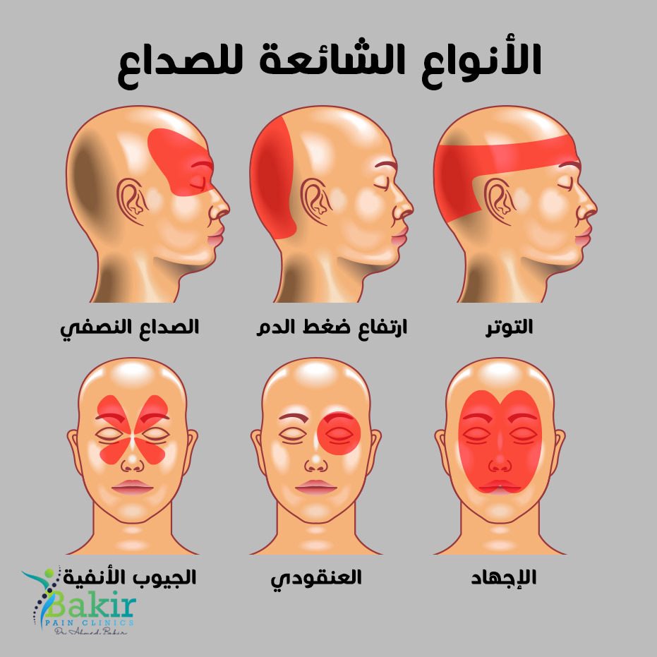 أشعة الشمس والصداع النصفي: كيف تواجه الأزمة الصحية؟