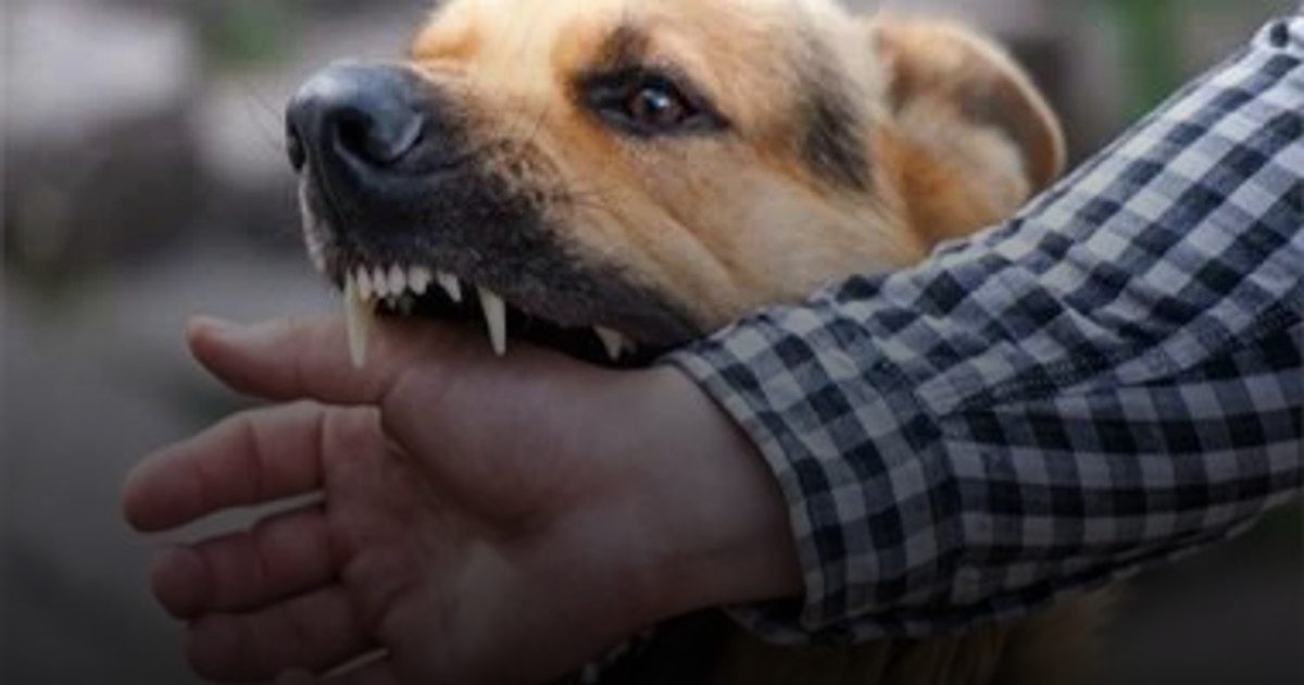 إسعافات أساسية عند التعرض لعضة كلب والعلاج ضرورة