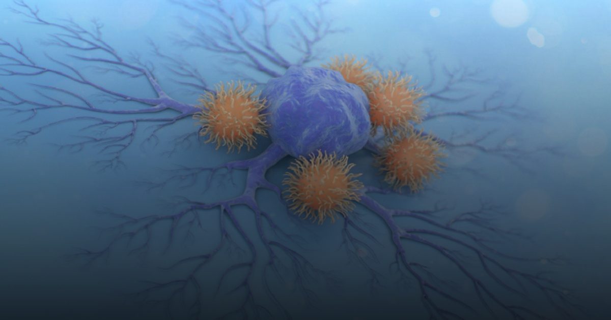 علاج ذكي يستهدف السرطان فقط ويحمي خلايا الجسم السليمة