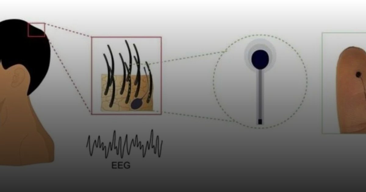 جهاز مرن بحجم الشعرة يلتصق بالرأس يراقب الدماغ 24 ساعة