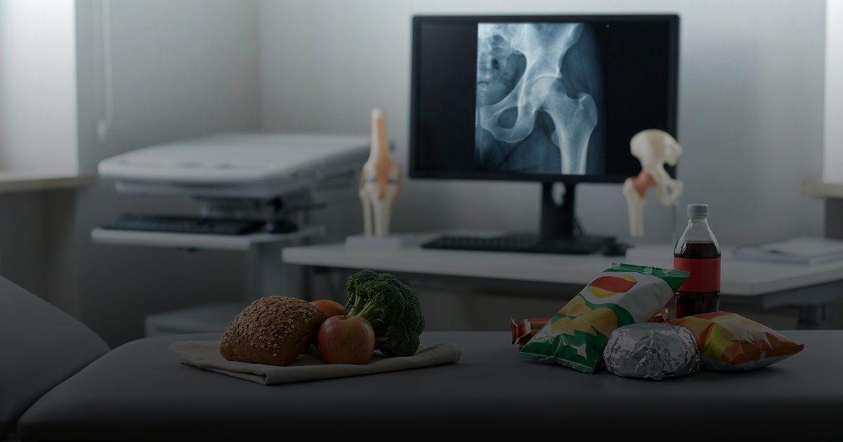 دراسة: الأطعمة المصنعة وصحة العظام مهددة