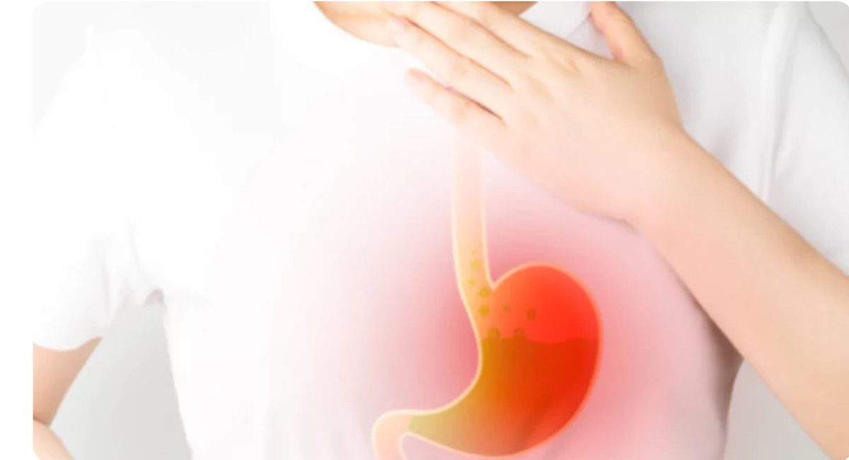 ارتجاع المريء: أسبابه وأعراضه وطرق علاجه