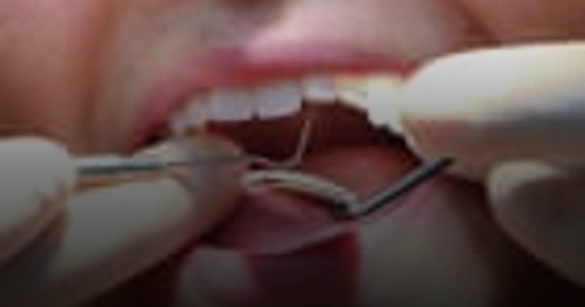 تحقيق في سوق طب الأسنان البريطاني الخاص