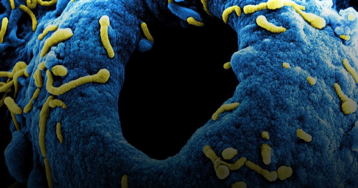 الصحة العالمية تحذر من فيروس ماربورغ "القاتل"..