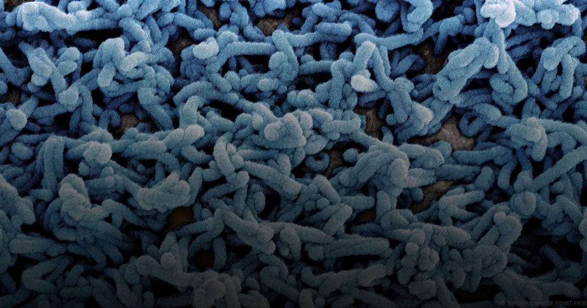 إثيوبيا تؤكد تفشي وباء "ماربورغ" في جنوب البلاد