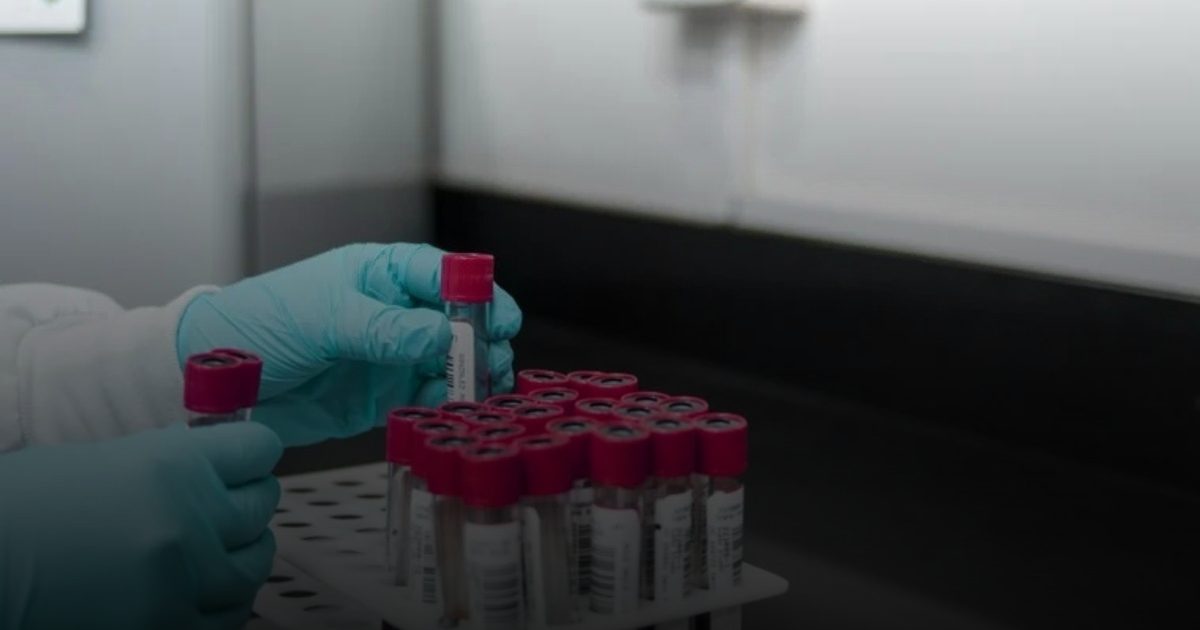 فصيلة دم قد ترفع خطر الإصابة بسرطان الثدي بنسبة 18%