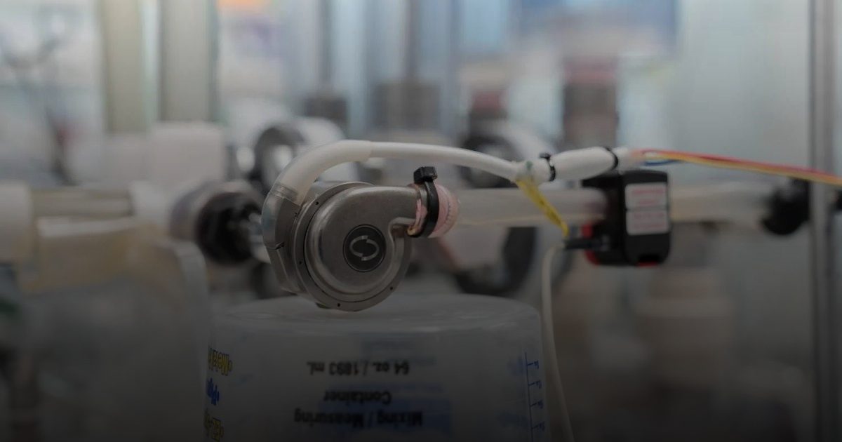 مضخة قلبية جديدة مخصصة لإنقاذ مرضى قصور القلب الانبساطي