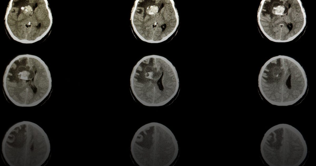 Servier تستحوذ على Day One بقيمة 2.5 مليار دولار