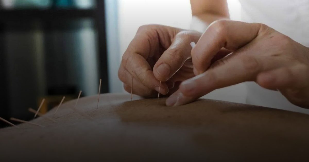 الوخز بالإبر يحسن الذاكرة ويقلل "ضبابية الدماغ" لدى الناجيات من سرطان الثدي