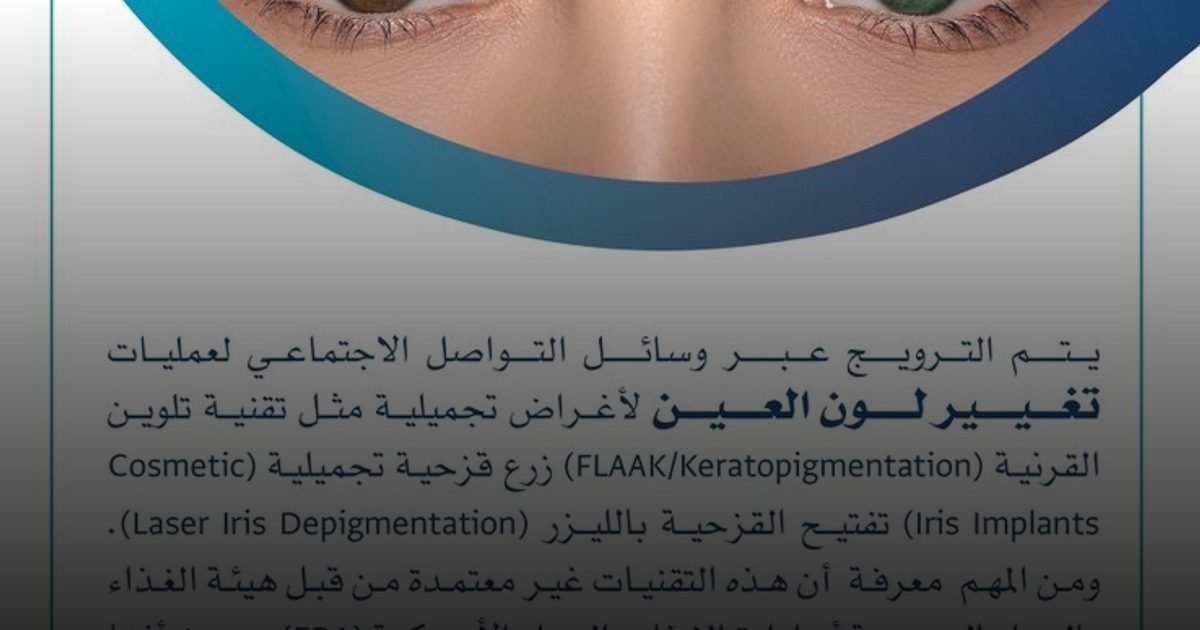 الملك خالد  التخصصي للعيون: تغيير لون العيون تقنية غير معتمدة ولها مضاعفات خطيرة