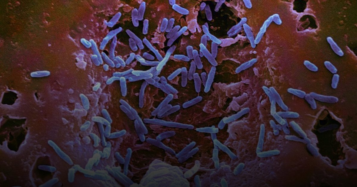 تحذير من منتجات خضراء ملوثة بالسالمونيلا