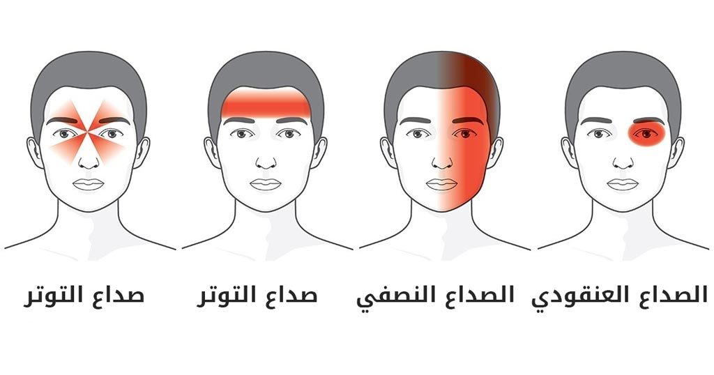 تعرف على 4 مراحل للصداع النصفي وكيفية التعامل معها