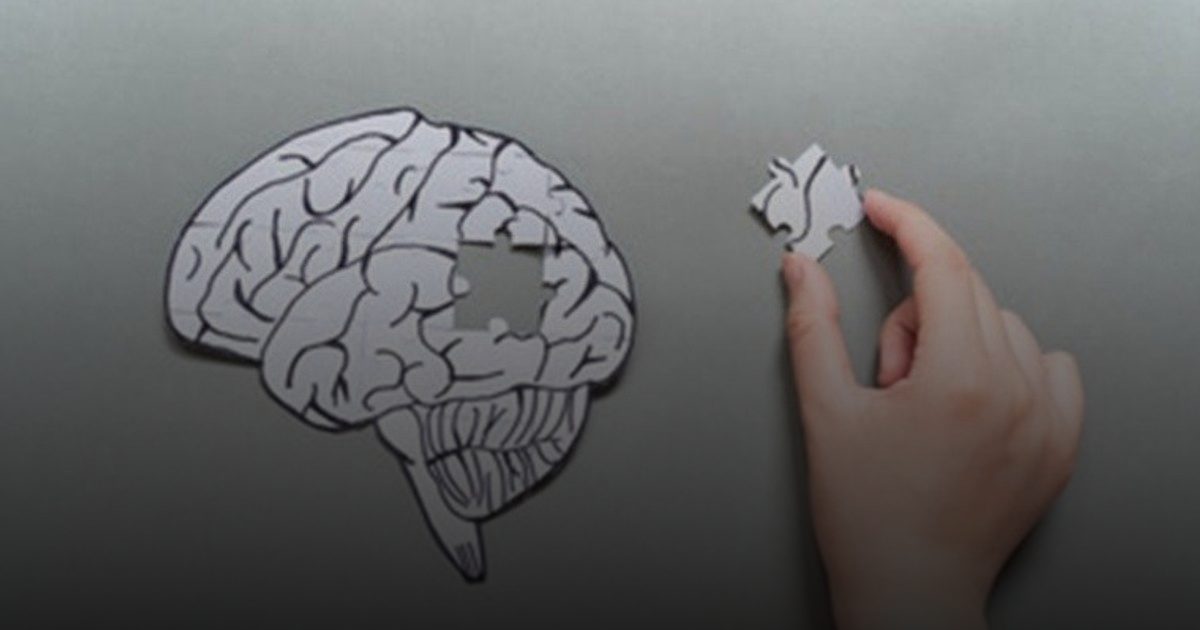 التحفيز المغناطيسي يعمل على إبطاء الزهايمر والتدهور المعرفي