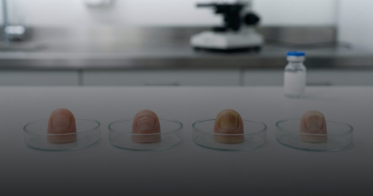 هل تعكس أظافرك صحة جسمك؟ مؤشرات طبية مفاجئة