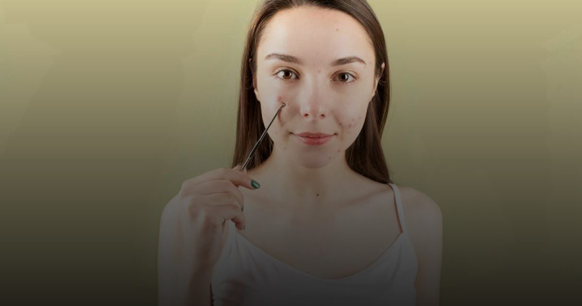 تخلصي منها: أسباب ظهور الرؤوس البيضاء وعلاجات فعالة تفتح المسام