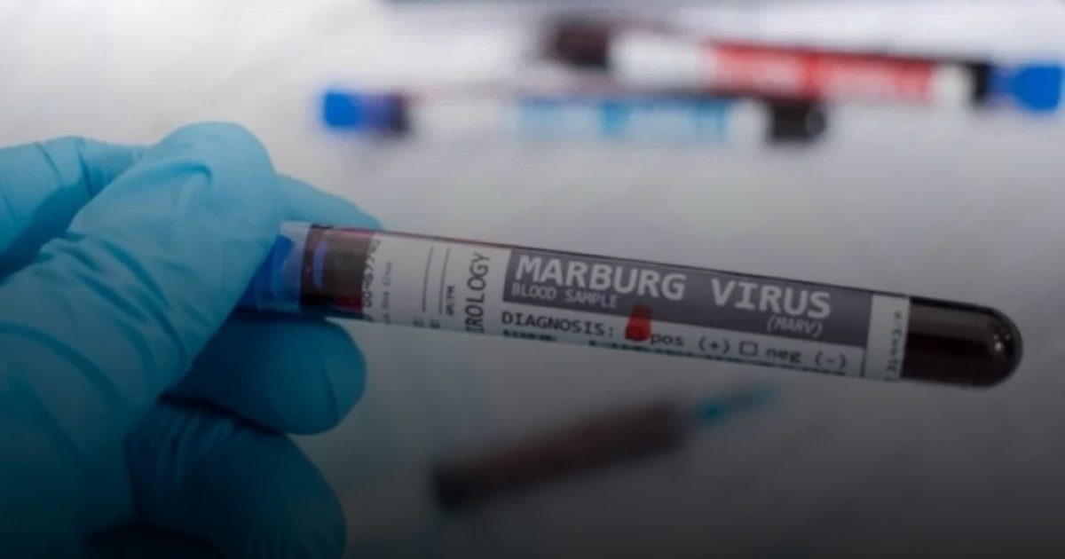 سفارة المملكة في إثيوبيا تحذر من السفر إلى مناطق تفشي "ماربورغ"