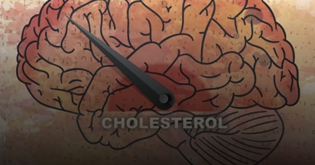 هكذا يؤثر الكوليسترول على الدماغ