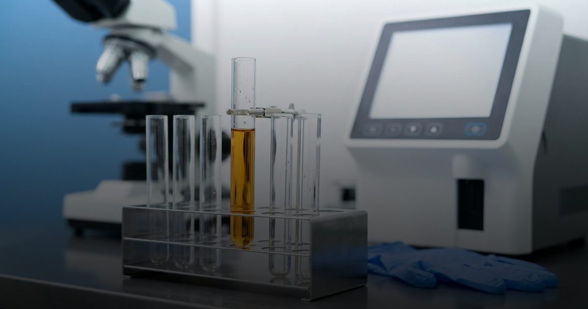 وظائف الكلى الحيوية والخطر الذي يهددها