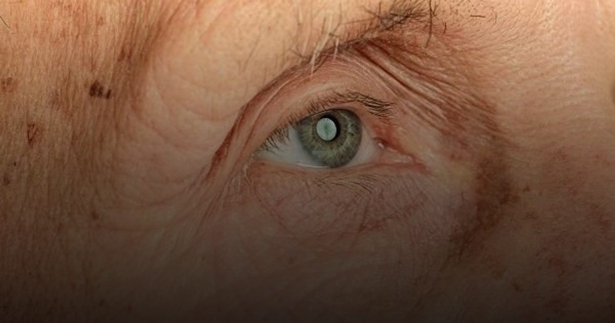 مكملات الميلاتونين قد تقي العينين من الضمور البقعي المرتبط بالشيخوخة