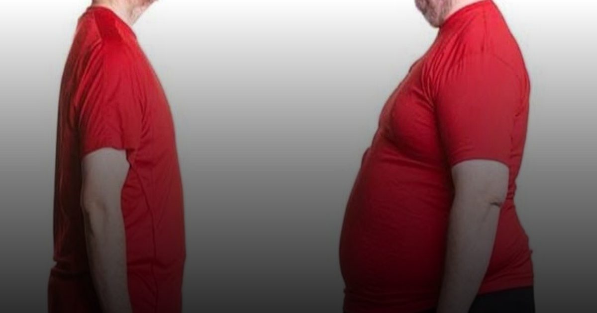 "النحافة الدهنية": دهون مخفية في الجسم النحيف تهدد الشرايين مثل السمنة